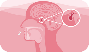 Testosterone levels can effect your stress levels